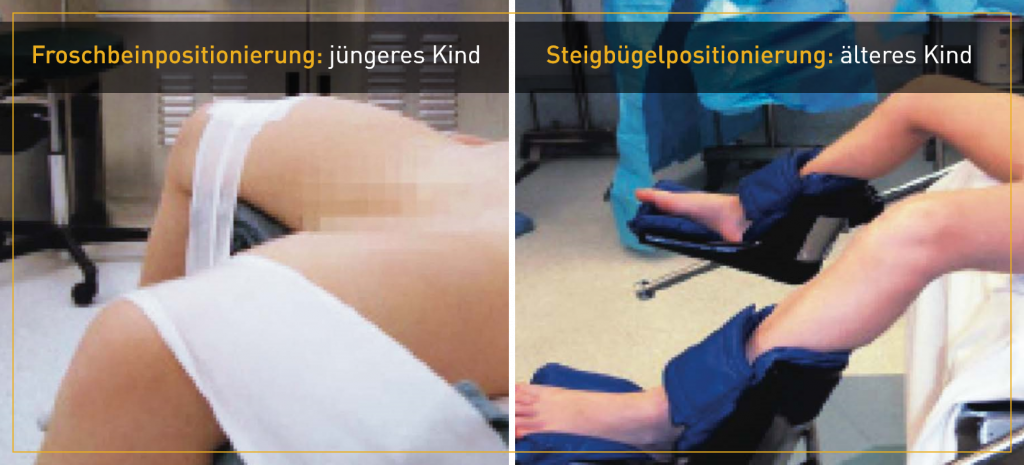 PatientPositioning_image-1-1024x465-de